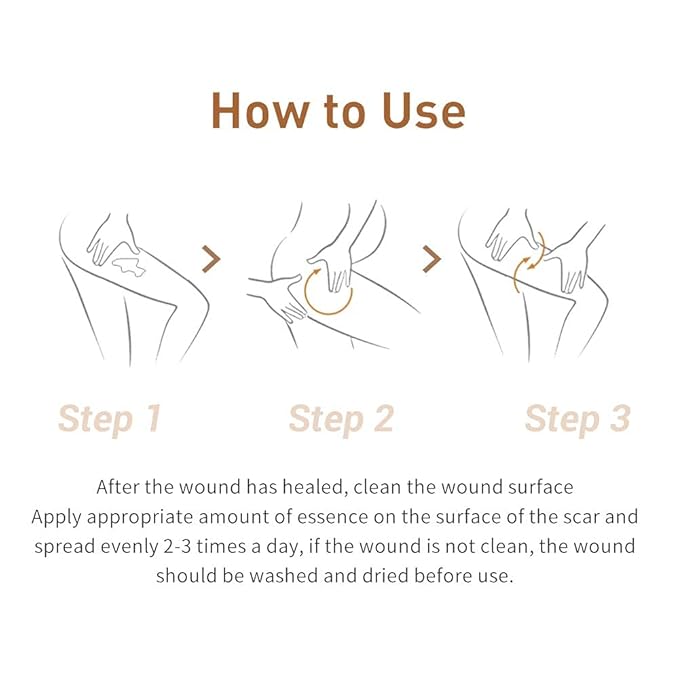 Acne Scar Removal Cream Stretch Marks Face Skin Cream Shrink Pores Gel-Fade Scar Marks Acne Skin Care (Packaging Upgrade) VeniCare