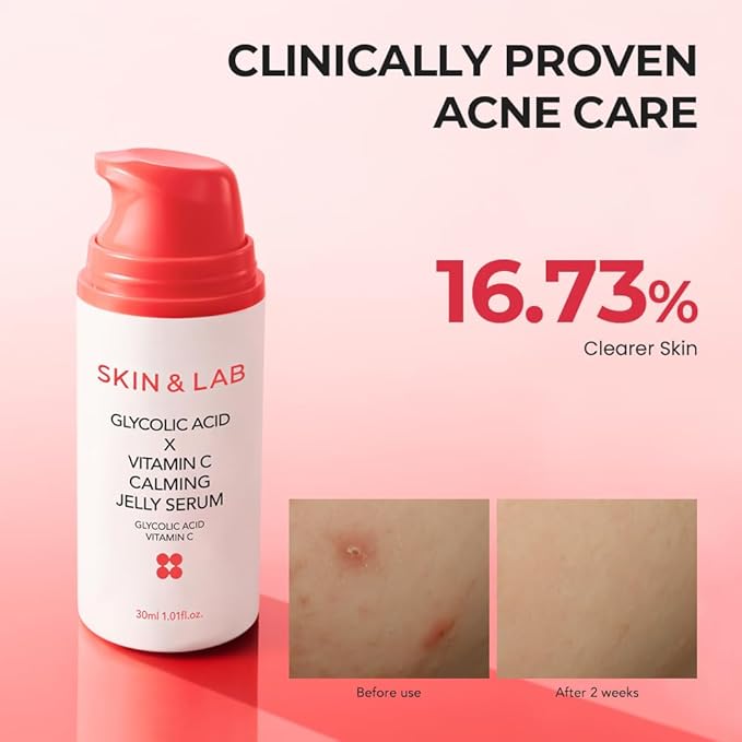 [SKIN&LAB] GLYCOLIC ACID X VITAMIN C CALMING JELLY SERUM, 1.01 fl. oz.