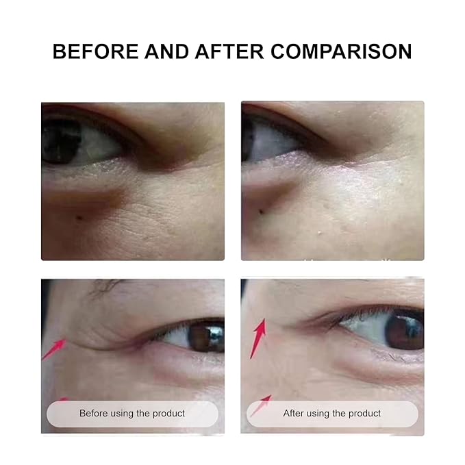 Under Eye Mask Wrinkle Patches, Under Eye Mask Amino Acid & Collagen,Eye Masks for Dark Circles and Puffiness,Eye Wrinkle Pads & Patches