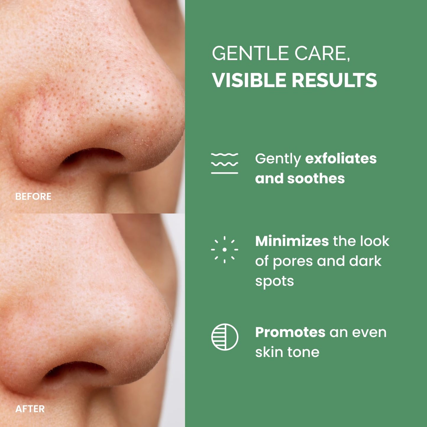 PLANTIFIQUE Korean Glycolic Acid Toner Pads 60 Pcs with Niacinamide, CICA - AHA BHA PHA Face Daily Peel Exfoliating Pads Formula for Gentle Skin Renewal for All Skin Types - Refillable Container