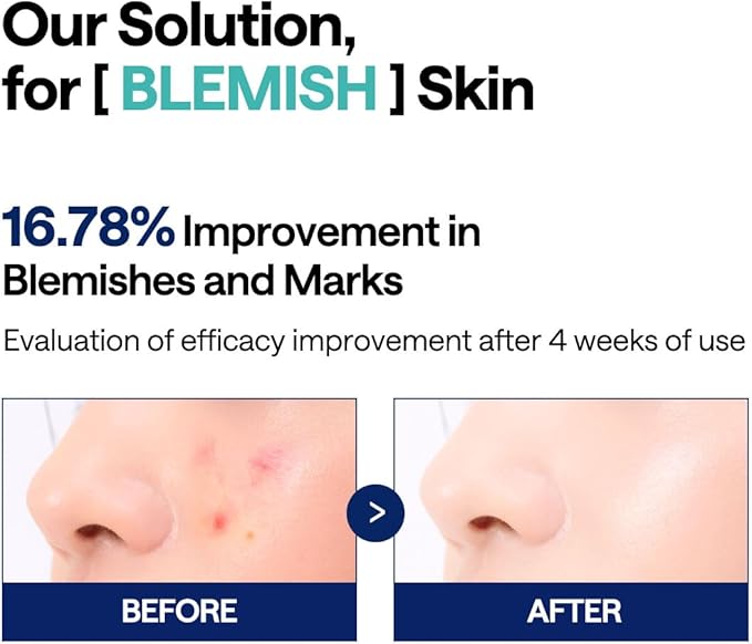 MEDIHEAL Madecassoside Blemish Pad - Square Cotton Facial Toner Pads with Centella Asiatica & Madecassoside – Anti Blemish to Improve Uneven Skin Tone - Vegan Face Gauze Pads, 100