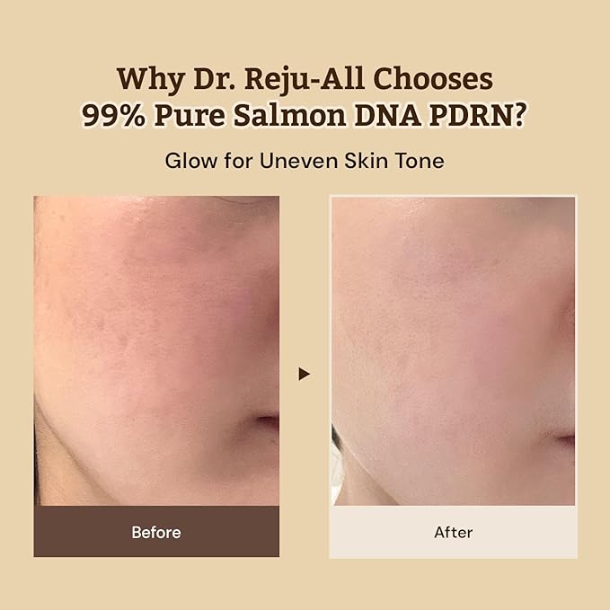 Dr. Reju-All Advanced PDRN Rejuvenating Cream + Advanced LC-Ceramide Barrier Cream - 99% Pure Salmon DNA PDRN Face Moisturizer - Patented Long Chain Ceramide - Korean Anti-Aging Skin Care Face Cream