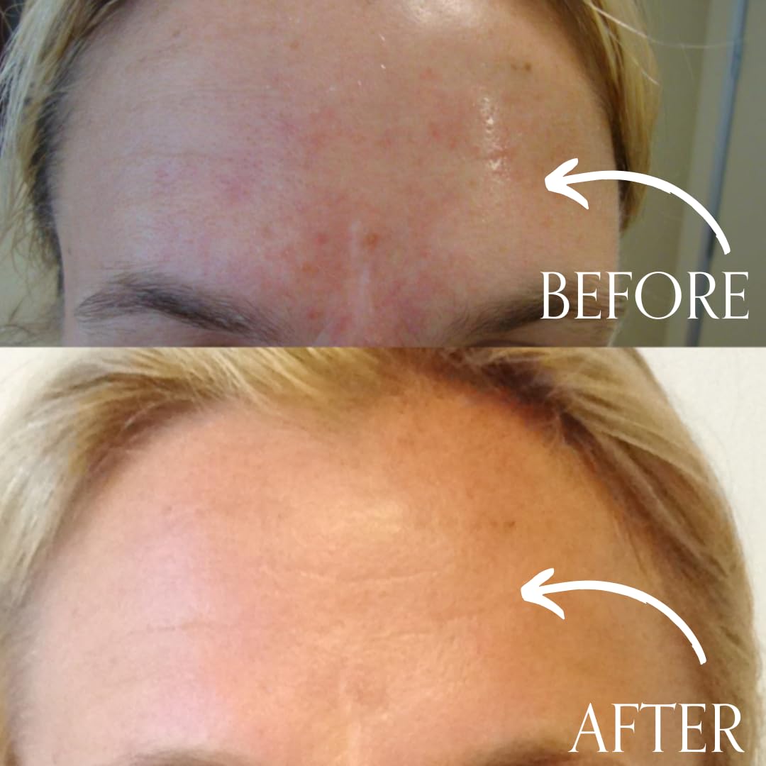 Radical Skincare Age Defying Exfoliating Pads Removes Dead Skin, Evens and Brightens Skin Tone for Radiant Glow | For All Skin Types Including Sensitive Skin | Paraben & Cruelty Free (15 Pads, 2 Pack)