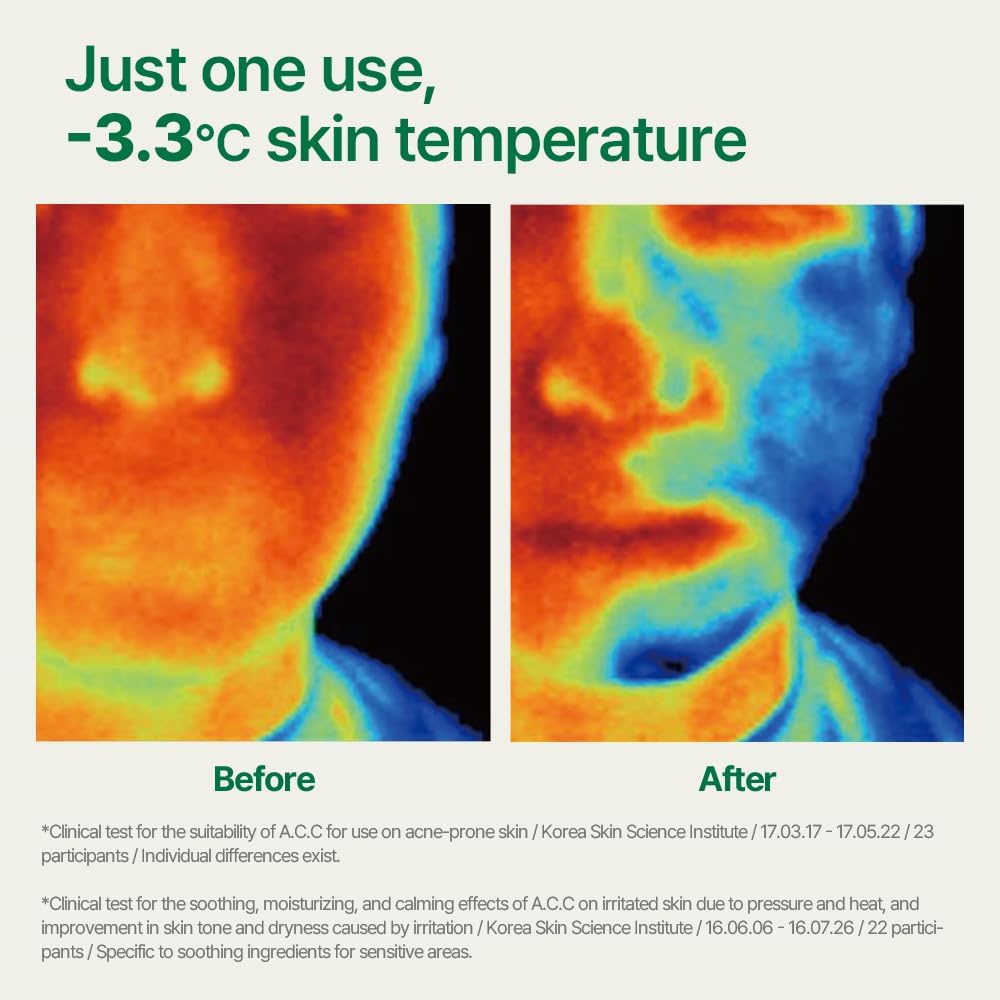 Pyunkang Yul PKY Ultimate Calming Solution Toner Pad for Sensitive Skin with Patented Ingredients, Intensely Calms & Soothes Rednes with CICA & Tea Tree, Korean Skincare (70 Pads)