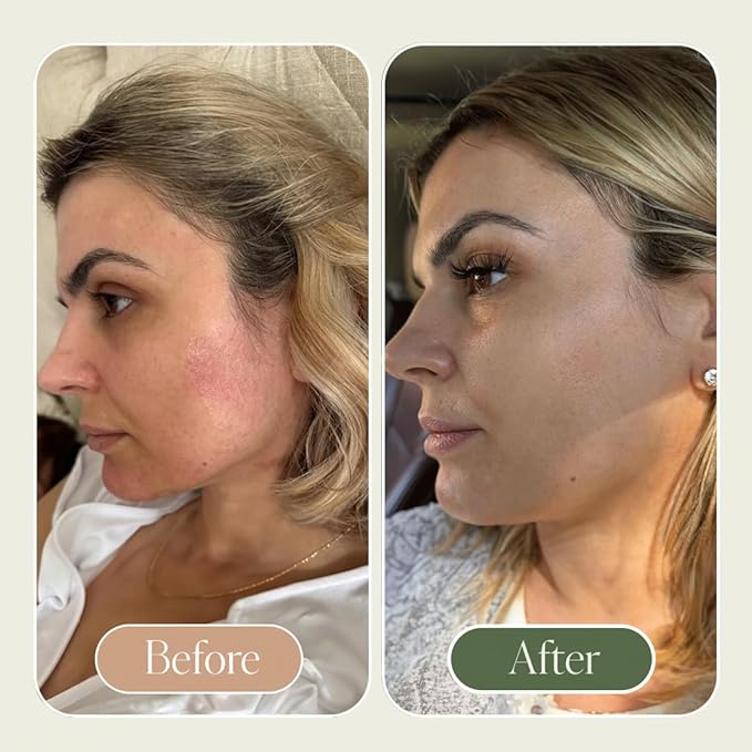 KUSHI Grass-Fed Whipped Tallow Cream Moisturizer for Face & Body – Organic Lavender – Vitamins A, D, E, K – Paraben & Sulfate Free, All-Natural Skin Care – 1.3oz