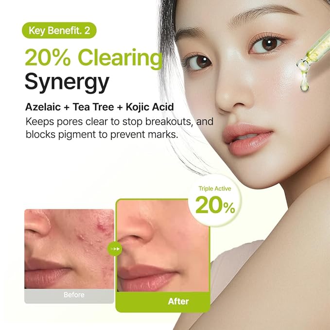 PURITO Azelaic Acid 10% + Kojic Acid + Tea Tree Facial Serum | for Acne & Marks, Breakouts | High-Level Azelaic Acid 10% | Korean skincare, 30mL 1.01 fl.oz