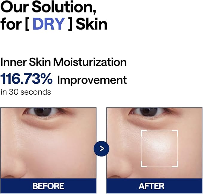 MEDIHEAL Watermide Moisture Pad - Square Cotton Facial Toner Pads with Icelandic Glacial Water - Improve Skin Temperature, Hydrating to Dry, Puffy, Coarse Skin -Vegan Eco Silk Pads,100