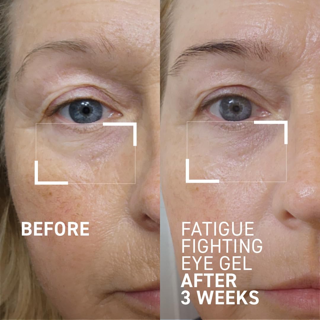 Dr. Brandt iD-Stress Icy Gel Moisturizer - Specifically Designed to Hydrate and Moisturize Your Skin - For A Glowing, Youthful-Looking Complexion - 0.5 fl oz / 15 ml