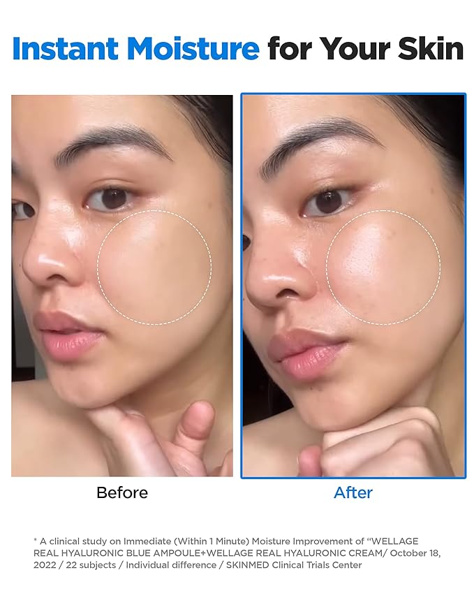 WELLAGE Real Hyaluronic Blue Ampoule 100, Value Review Korean Skincare, Fragrance Free Hyaluronic Acid Serum with Panthenol, Wild yam, Centella, Deep Hydration, Firming, Plumping, Non-Sticky 2 Pack