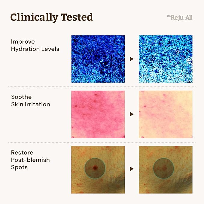 Dr. Reju-All Advanced PDRN Rejuvenating Cream + Advanced Retino-Mela Serum - 99% Pure Salmon DNA PDRN Face Moisturizer - HPR Retinol Serum - Korean Anti-Aging Skin Care - Gentle & Beginner-Friendly