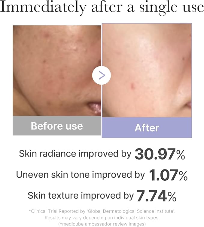 medicube Ultimate Pink Glow Skincare Trio: Mini Booster Pro Pink and Collagen Overnight Wrapping Peel Off Facial Mask Pack and Triple Collagen Serum 1.85 fl.oz (50ml) | Holiday Stocking Stuffers