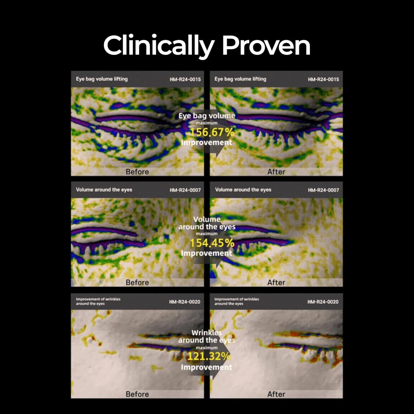 Eyephalt Eyebag Cream for Puffiness, Dark Circles & Fine Lines, Wrinkle, EGF Anti-Aging Under Eye Moisturizer with Niacinamide&Ceramide 0.33 fl.oz.