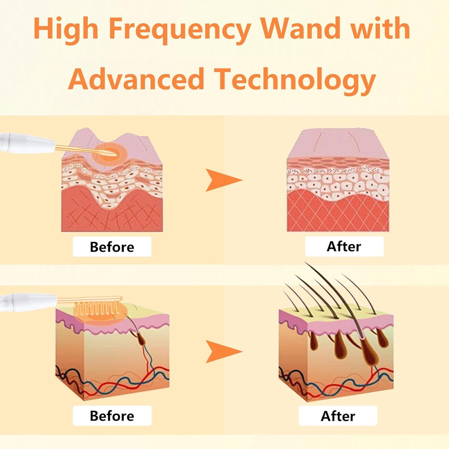 High F Rrequency Facial Wand for Face Care, Multi-Function Face Device Machine
