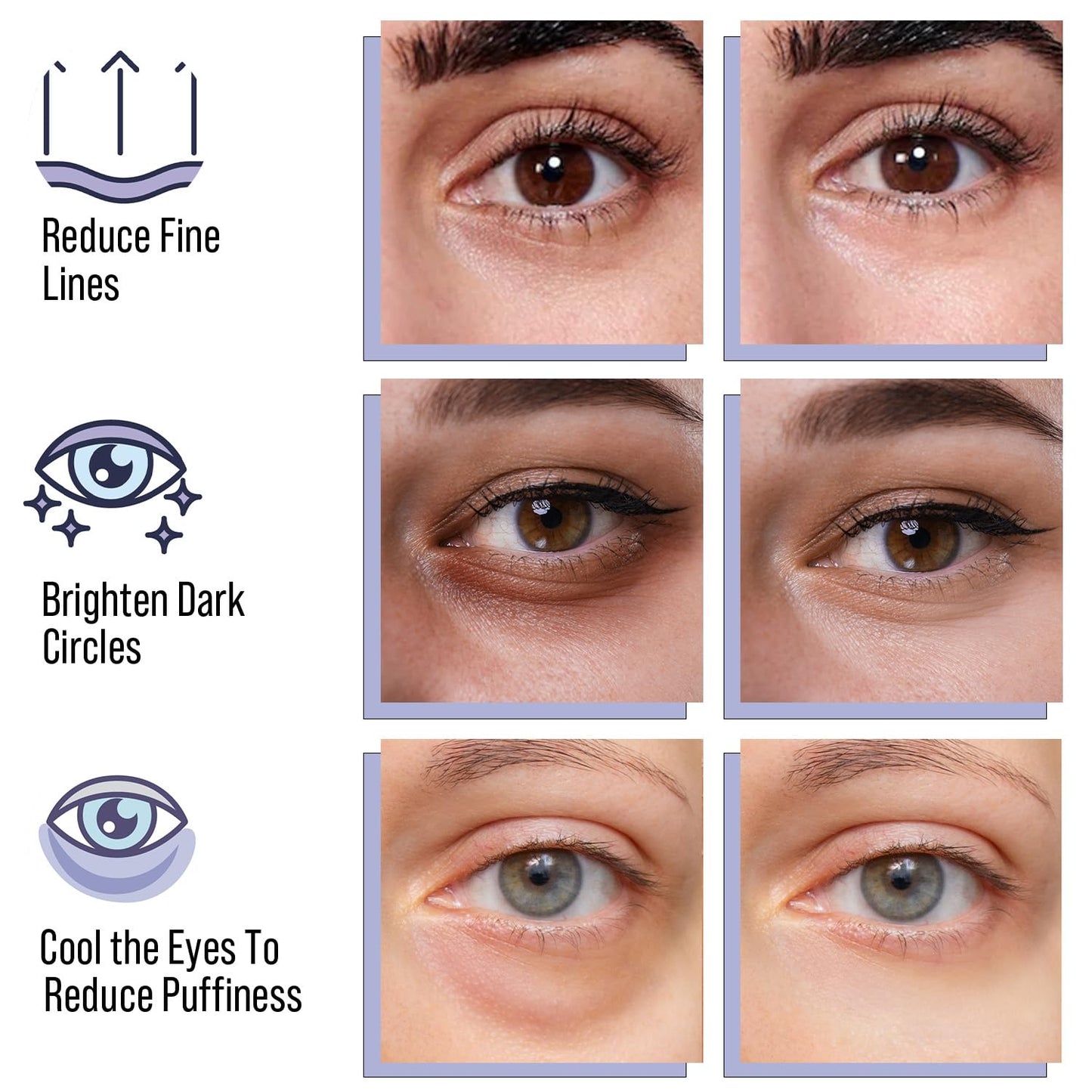 DIAMOND GAZE Under Eye Patches 28 Pairs, Rejuvenate Eye Area, Soothing Hydrate Brighten Skin, Plumps Fine Lines, Hydrogel Eye Mask with Retinol, Niacinamide and Polyglutamic Acid, Eye Gel Pads