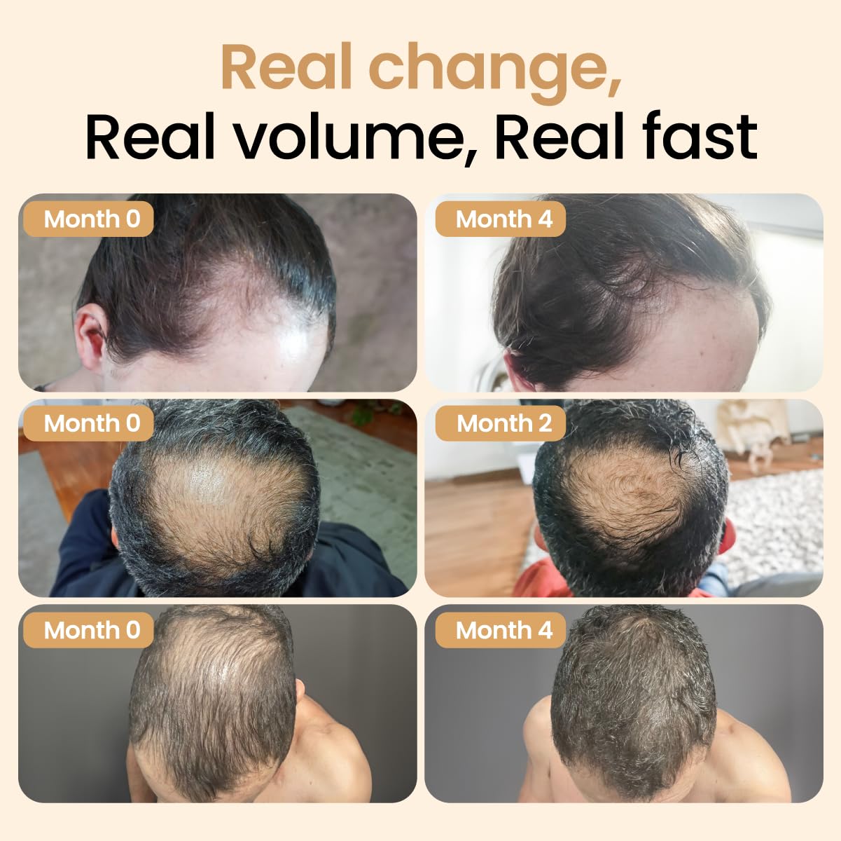 Hair Booster for Women & Men – Hair Revitalizing Serum with Capilia Longa & Arginine for Thick, Dry, Long, Damaged Hair – Peptide-Enriched Hair Tonic, 2 Fl Oz - Pack of 2