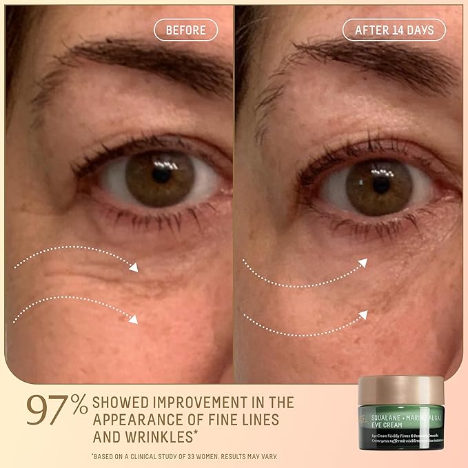 Biossance Uplifting Glow Holiday Set, Firm and Lift Serum, Marine Algae Eye Cream, Omega Repair Cream ($112 value), 1 Set