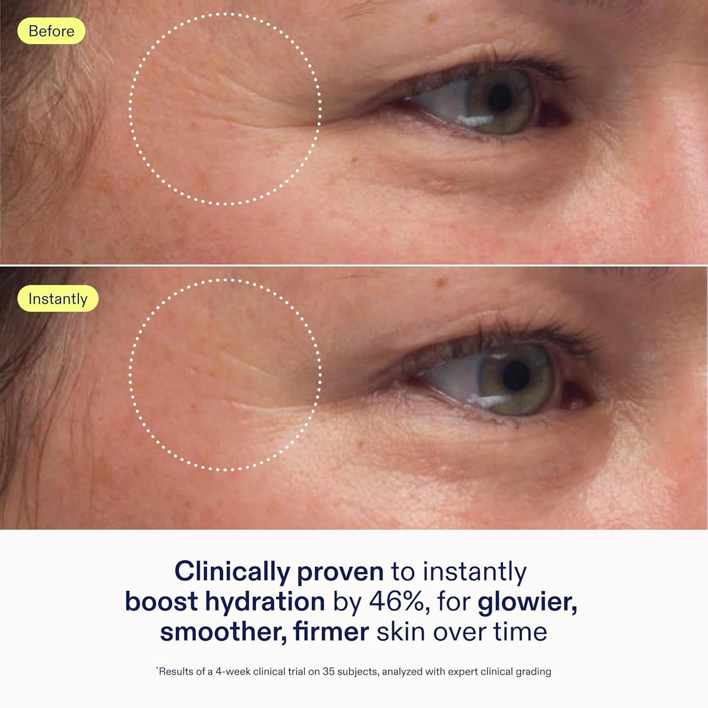 Skinfix Triple Lipid-Peptide Cream Mini - 0.5 oz - Rich Face Moisturizer to Instantly Hydrate & Restore Dry, Sensitive Skin - Non-Comedogenic, Fragrance Free, Vegan, Cruelty Free