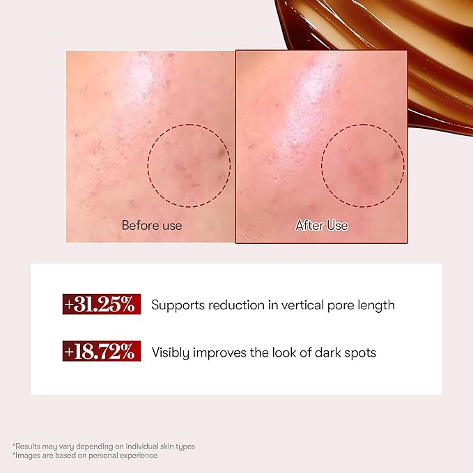 VT COSMETICS Red Booster Reedle Shot 100, Microneedling Serum with Dragon’s Blood, Exosome, Soothing Relief Serum for Irritated, and Sun-Stressed Skin, Scalp Care, Korean Skincare 1.69 fl oz (50ml)