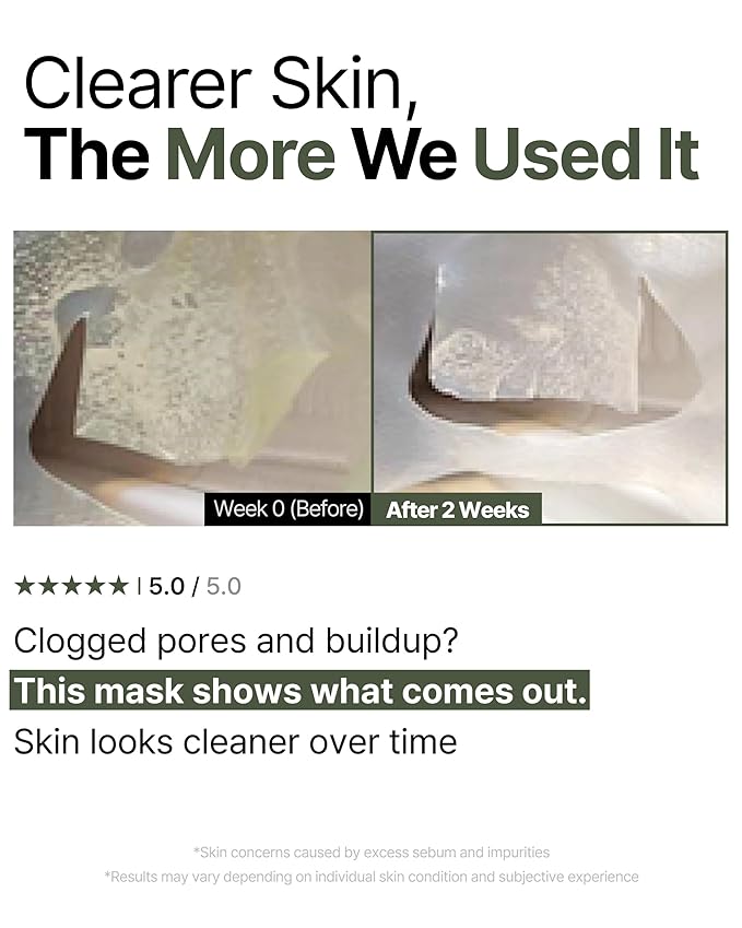 Trouble Patch Mask – Full-Face Acne & Sebum Control Korean Sheet Mask with Tea Tree Biome, Hydrocolloid-Inspired Care for Oily Skin, Visible Sebum Lift, Holiday Skincare Gift | 20ml x 4