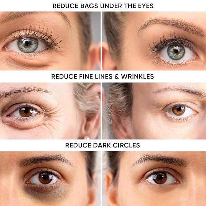 Instant Eye Tightener Cream - Reduces Under Eye Puffiness, Bags, Dark Circles. Lift Technology to Tighten & Firm Sagging Skin Around Eyes. Smooths Away Crow’s Feet, Fine Lines & Wrinkles.