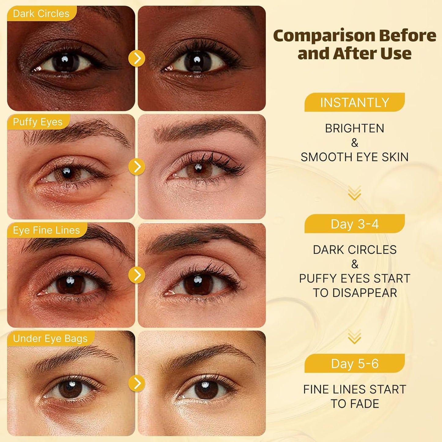 Under Eye Patches 20 Pairs, Golden Eye Mask for Undereye Bags & Puffy Eyes, Cooling Eye Care for Dark Circles & Wrinkles, Eye Mask Patches with Hyaluronic Acid & Collagen, Skincare Treatment for Adult