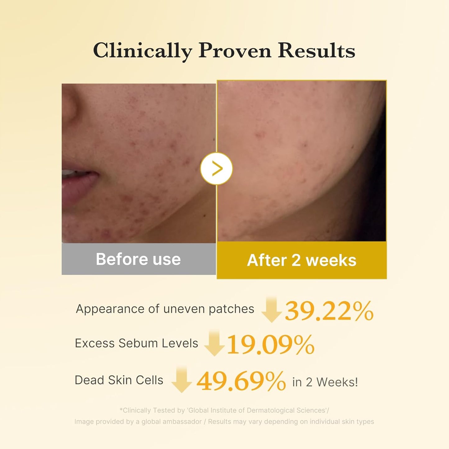 medicube Kojic Acid Turmeric Clarifying Toner Pad for Troubled Skin & Use After Spot Care | Soothing & Calming with Kojic Acid, Turmeric, Niacinamide, and Glycolic Acid | Korean Skin Care, 70 Pads