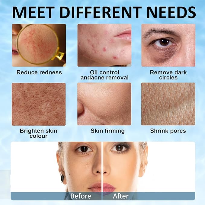 Ice Face Roller, Joyeee Silicone Ice Roller For Face and Eyes Puffiness Relief Reusable Face Ice Cubes Migraine Pain Relief Facial Ice Mold Skincare Tools Gifts for Women Beauty