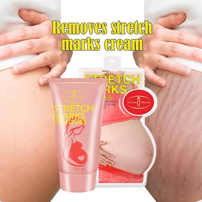 AICHUN BEAUTY Pregnancy Cream Streach Mark Remover Scars Repair Cellulites Lotion Cream 150ml