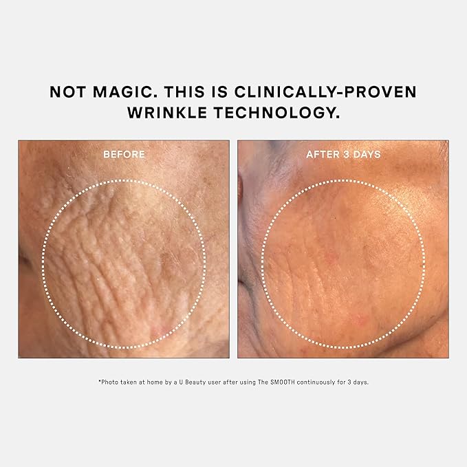 U Beauty The SMOOTH Dynamic Wrinkle Defense Serum - Multi-Peptide Complex, Copper Peptides, Retinol, Centella Exosomes, Vegan Silk Protein for Visible Wrinkle Reduction, Firming & Hydration, 15ml