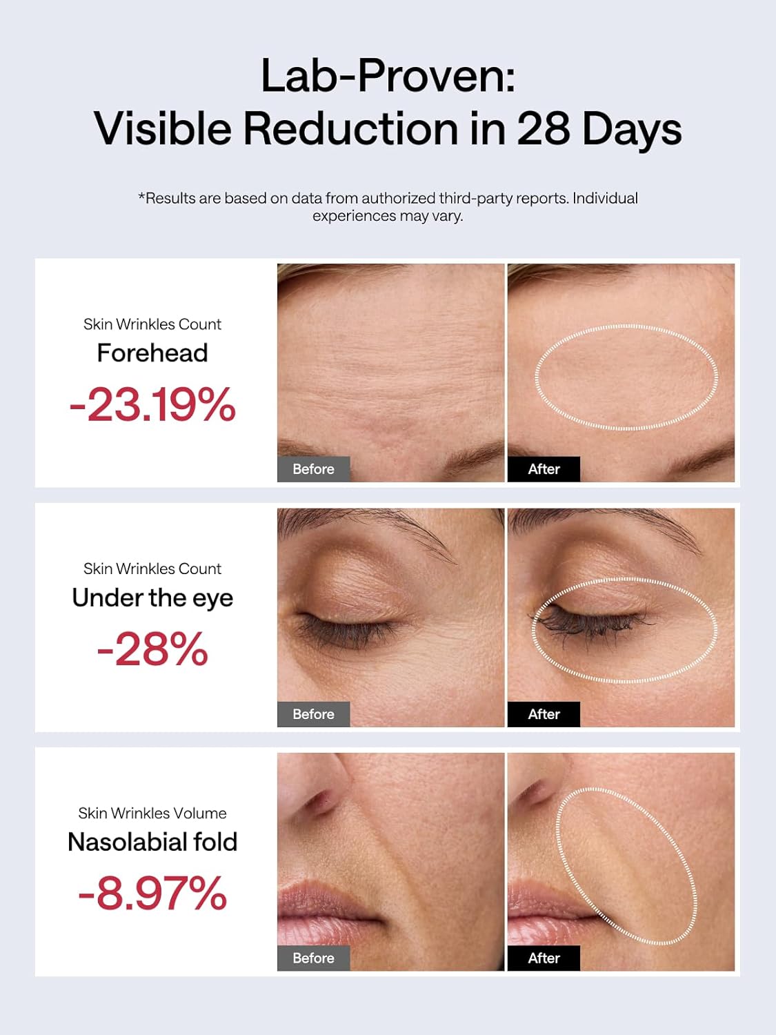 JMOON NouvelleSkin Facial Toning Device, FDA-Cleared Microcurrent Facial Device and Red Light Therapy for Face, 4 Modes & 5 Intensity Levels for Personalized Face Lift & Smoothing. M30U PR