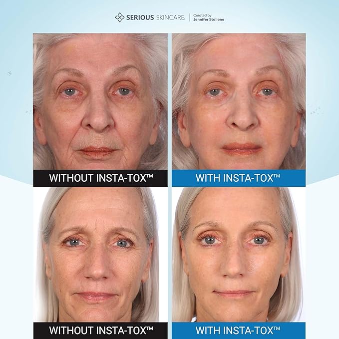 Serious Skincare INSTA-TOX Instant Wrinkle Smoothing Face Serum - Improves Appearance of Fine Lines - Temporary Skin Tightener - Line Filler .75 oz (1Pack)