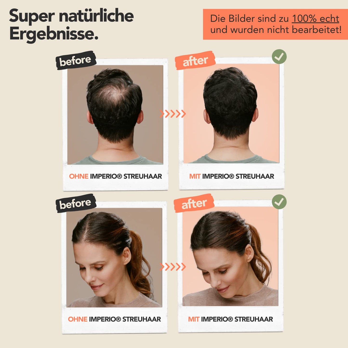 IMPERIO Hair Building Fibers for Thinning Hair - 26g Premium Hair Fibers for Women & Men in Hairdresser Quality - Hair thickening in less than 20 seconds (Medium Brown)