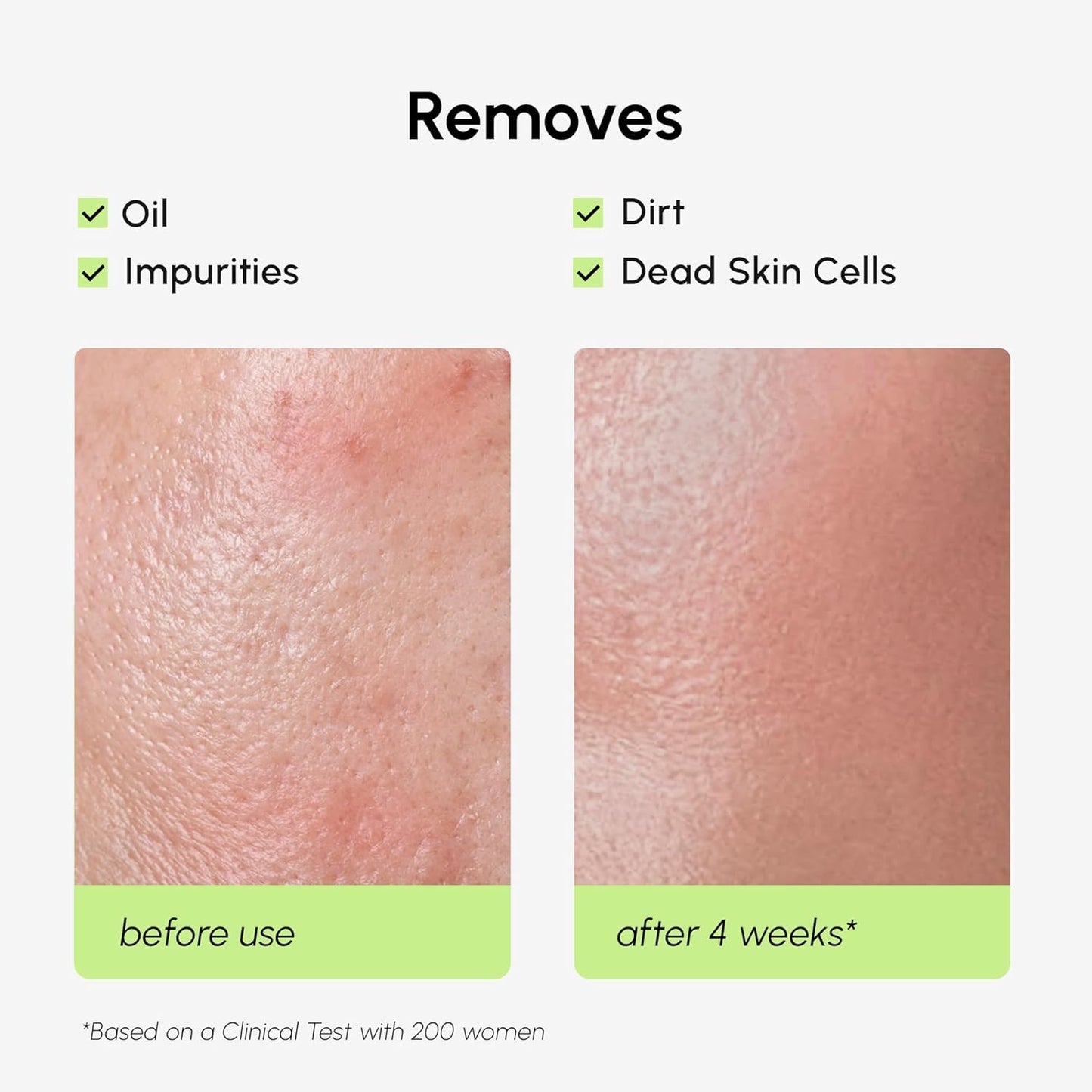 MAREE Exfoliating Toner with Salicylic Acid – AHA BHA Exfoliant & Face Exfoliator Pore Cleaner – BHA Liquid Exfoliant – Sebum Dead Skin Care Remover for Face – Exfoliante Para la Cara Acido Salicilico