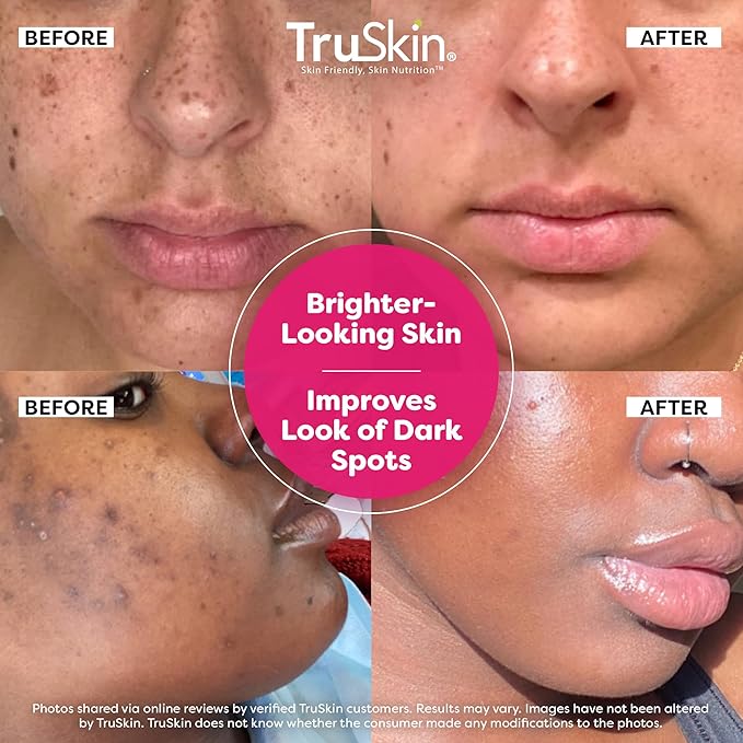 TruSkin Vitamin C Super Serum - Niacinamide, Retinol, Hyaluronic Acid & Squalane - All-in-One Anti Aging Serum for Face – Improve Appearance of Dark Spots, Firmness for Brighter Looking Skin, 1 Fl Oz