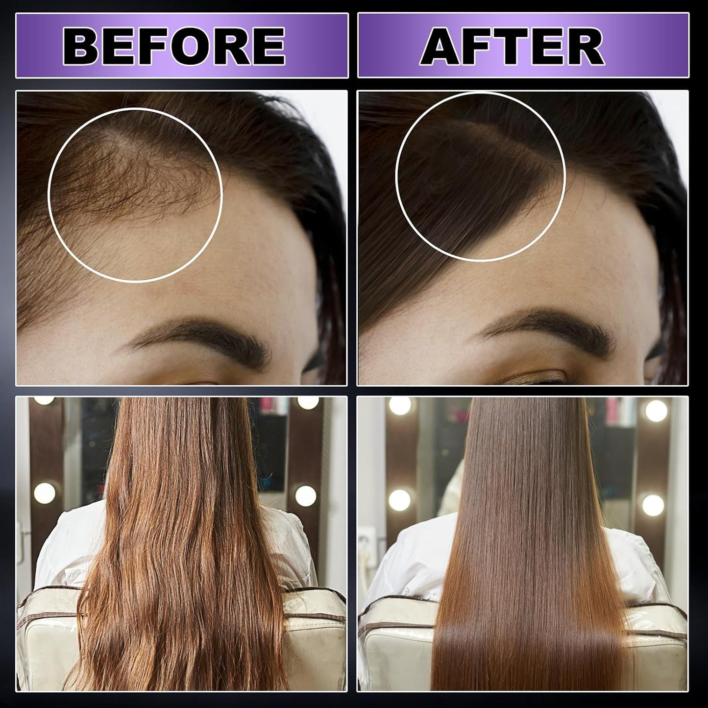 GIFBEA Organic Black Rice Water Hair Growth Serum Spray, 5 Fl Oz, Rosemary Scent, For All Hair Types, With Biotin, Castor Oil, Caffeine, Hair Loss Treatment