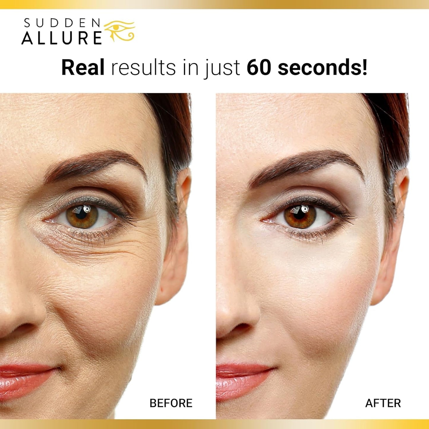 Sudden Allure Instant Under Eye Treatment Serum – Erase Under Eye Bags, Dark Circles, Wrinkles & Lift Sagging Eyes - Instantly Tighten & Firm - Reduce Eye Bags & Crows Feet | Made in USA (10 ml, 2pk)