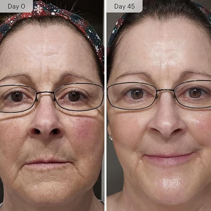 Qure Micro Infusion System for Face & Neck - Facial Moisturizing Essence, Hydrating Serum for All Skin Types, Refreshed Skin - 3-Month Supply