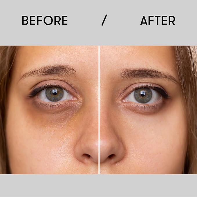 Sane Eye Cream for Dark Circles and Puffiness Treatment with Caffeine and Niacinamide - 0.34 fl oz, Hydrating Eye Cream for Dark Circles, Mornings without Puffiness